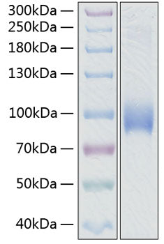 Recombinant Human SELL/L-selectin/LAM-1/CD62L Protein