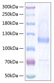 Recombinant Human Thrombospondin-5/COMP Protein