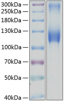 Recombinant Human Osteoactivin/GPNMB Protein