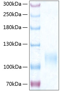 Recombinant Human SELE/E-selectin/CD62E Protein