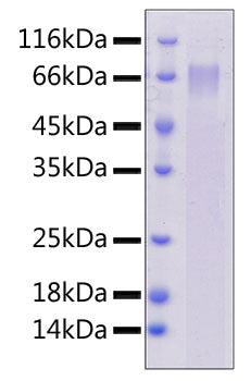 Recombinant Human DLL4 Protein