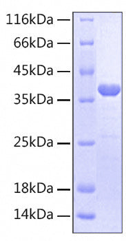 Recombinant Human IL-2RB/CD122 Protein