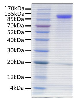 Recombinant Human Siglec-4a/MAG Protein