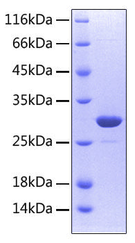 Recombinant Human TNFRSF11A/CD265 Protein