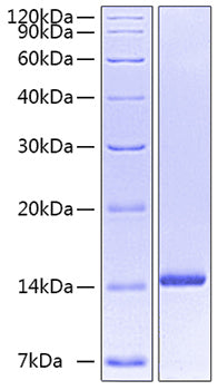 Recombinant Human Neurotrophin-3/NGF-2/NT-3 Protein