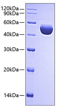 Recombinant Human Serpin E1 Protein