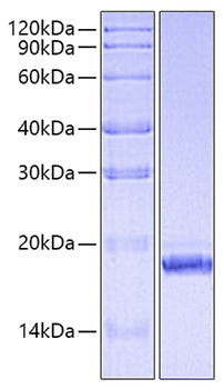 Recombinant Human IFNA6/IFN-alpha 6/LeIF K Protein