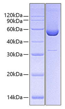 Recombinant Human Serpin H1/HSP47 Protein