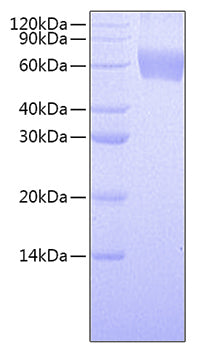 Recombinant Human CSF2RA/GMCSFR-alpha/CD116 Protein