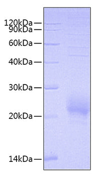 Recombinant Human BY55/CD160 Protein