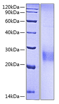 Recombinant Human KP43/CD94 Protein