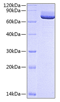 Recombinant Rat CD73/5'-Nucleotidase/NT5E Protein