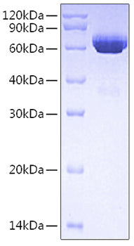 Recombinant Human tPA/Tissue-type plasminogen activator/PLAT Protein