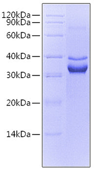 Recombinant Mouse TNFRSF12A/TWEAK R/CD266 Protein