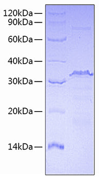 Recombinant Human Transcriptional Repressor Ctcf/Ctcf Protein