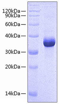 Recombinant Human Follistatin-like protein 1/FSTL1 Protein