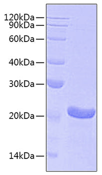 Recombinant Human Ferritin heavy chain/FTH1 Protein