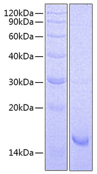 Recombinant Mouse IL-21 Protein