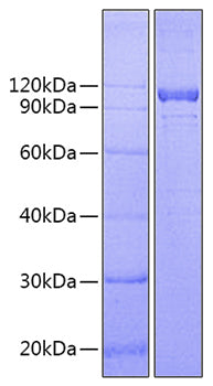 Recombinant Human IL12RB1/CD212 Protein