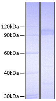 Recombinant Mouse IL-23R Protein