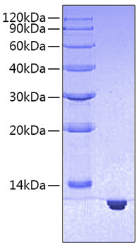 Recombinant Human S100-B Protein