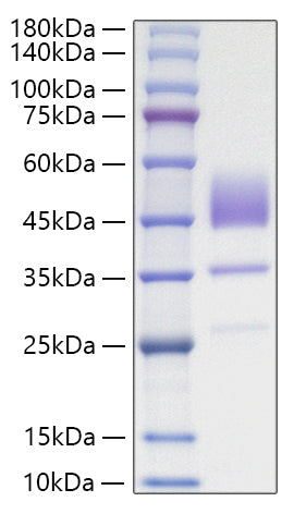 Recombinant Human Brain Natriuretic Peptide/BNP Protein