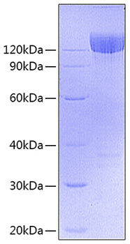 Recombinant Mouse PDGFRA/PDGF R alpha/CD140a Protein