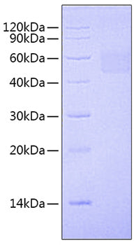 Recombinant Mouse IL-1 R2/IL-1 RII Protein