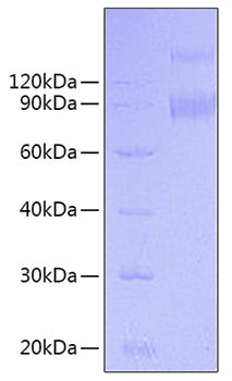 Recombinant Mouse IL-1 R1/IL-1 RI Protein