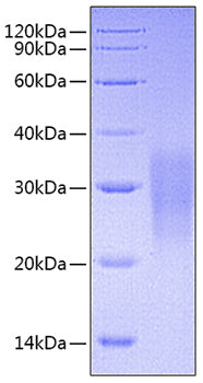 Recombinant Mouse TNFRSF6/CD95/FAS Protein