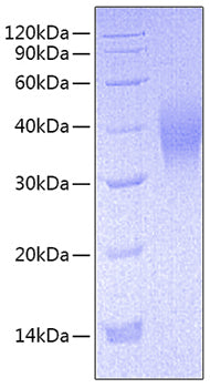 Recombinant Mouse Fc-gamma RIII/CD16 Protein