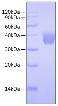 Recombinant Mouse TNFSF9/4-1BB Ligand Protein