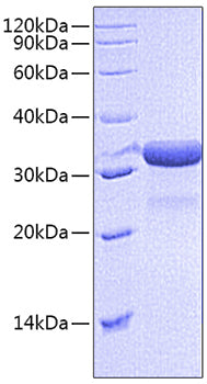 Recombinant Mouse IGFBP-7 Protein