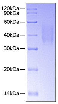 Recombinant Human TNFRSF10C/TRAIL R3 Protein