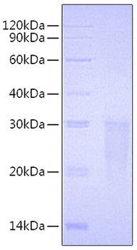 Recombinant Human TMIGD2/CD28H Protein