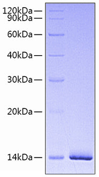 Recombinant Human Estrogen receptor/ESR1 Protein