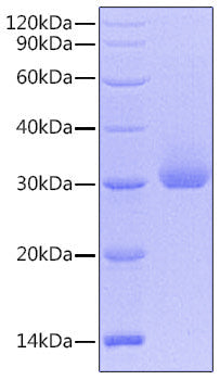 Recombinant Human Kallikrein-4/KLK4 Protein