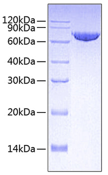 Recombinant Human MMP-2 Protein