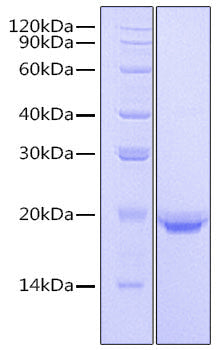 Recombinant Human IL-17F Protein