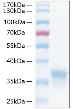 Recombinant Human HCVADR/CXADR Protein