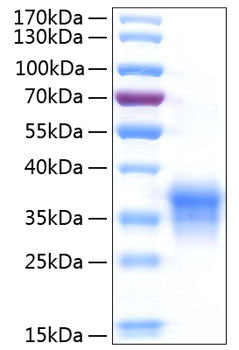 Recombinant Human IFN-lambda 1/IL-29 Protein