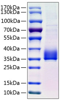 Recombinant Human Angiopoietin-like 3/ANGPTL3 Protein