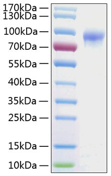 Recombinant Human IL-2RG/CD132 Protein