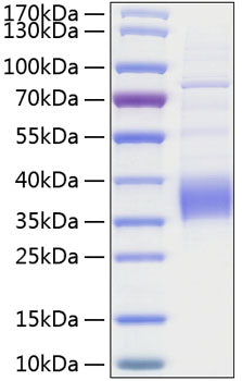 Recombinant Human TROP-2/TACSTD2 Protein