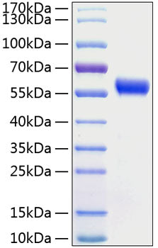 Recombinant Human Frizzled-5/FZD5 Protein