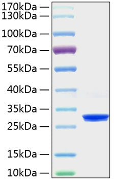 Recombinant Mouse C-Reactive Protein/CRP Protein