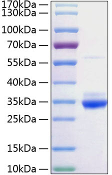 Recombinant Rat C-Reactive Protein/CRP Protein