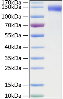 Recombinant Mouse SELE/E-selectin/CD62E Protein