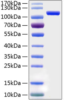 Recombinant Human Semaphorin-5A/SEMA5A Protein