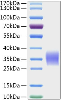 Recombinant Human Activin RIIA/ACVR2A Protein